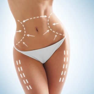 Cirurgia Plástica