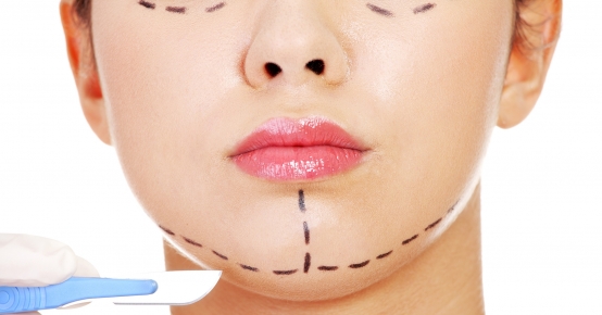Face Lift - Rejuvenescimento Facial