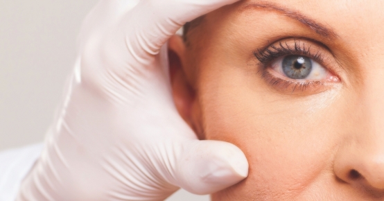 Blefaroplastia | Cirurgia das Pálpebras