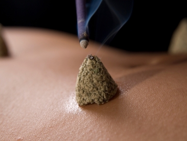 Acupuntura e cólica menstrual
