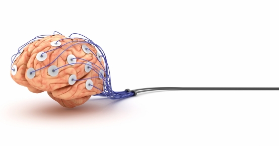 Neurologia Geral